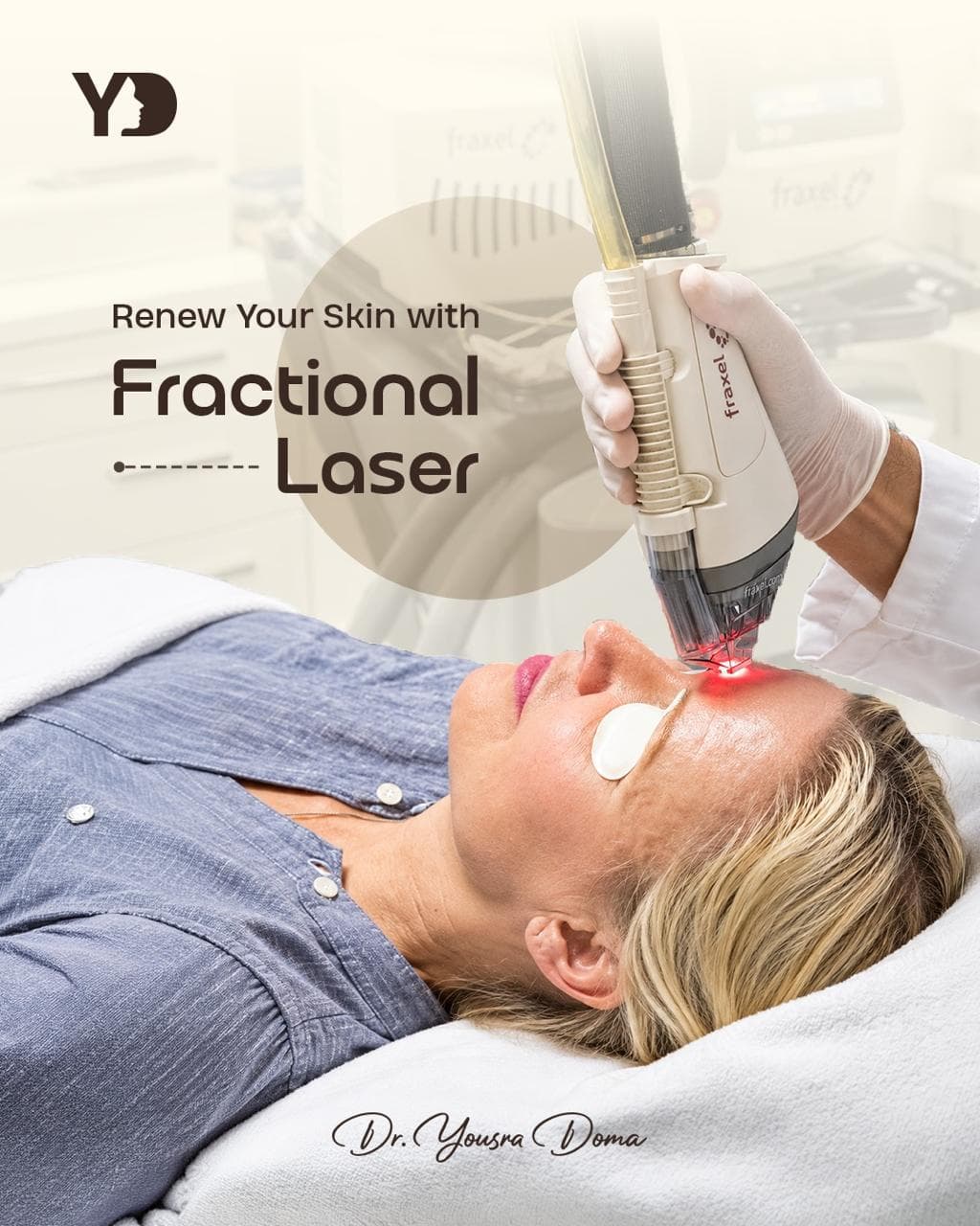 Fractional laser